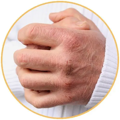 Dryskin